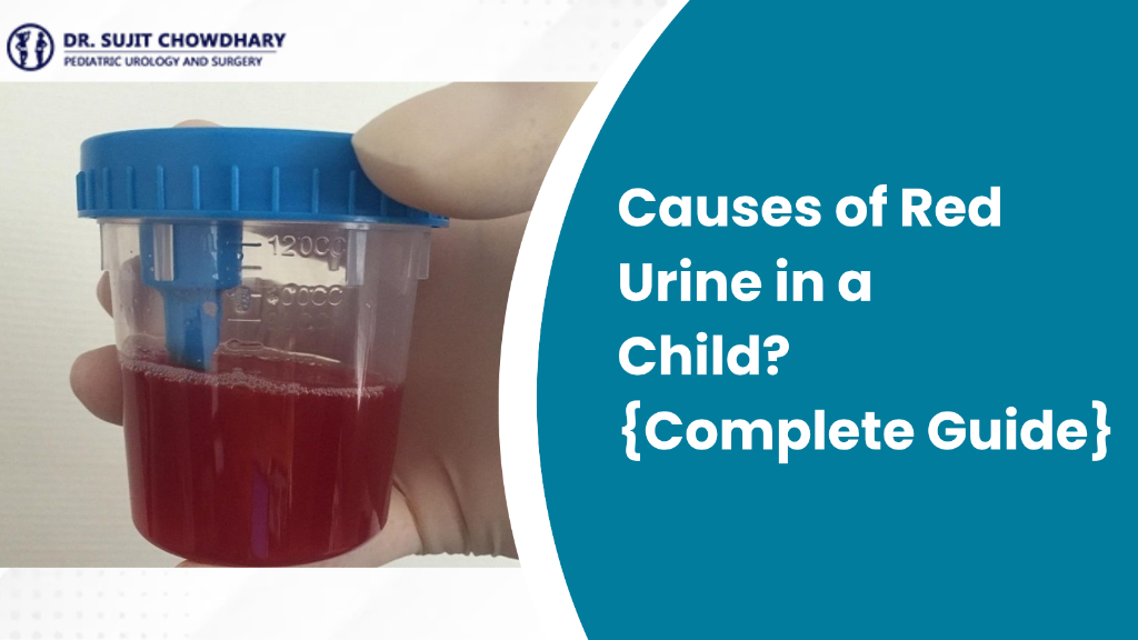 Causes of Red Urine in a Child? {Complete Guide}